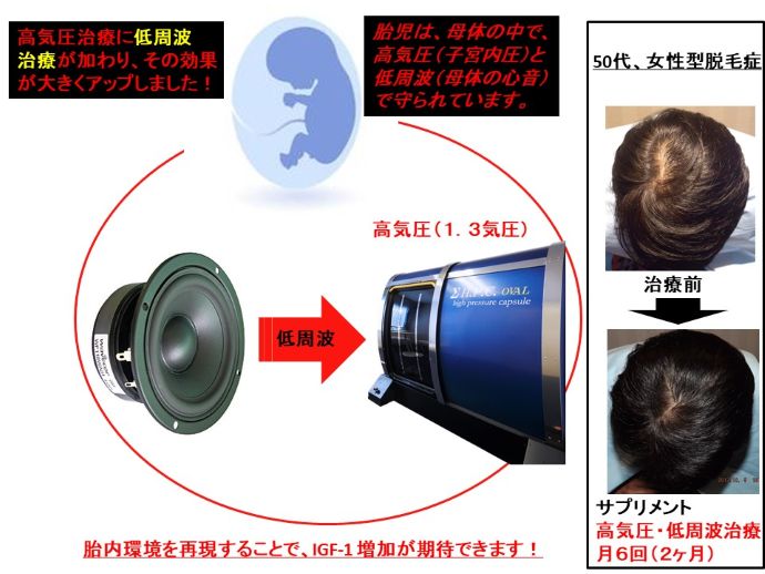 円形脱毛症　病院